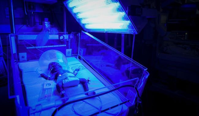 IMSS refuerza atención neonatal con tecnología y protocolos especializados para nacimientos prematuros