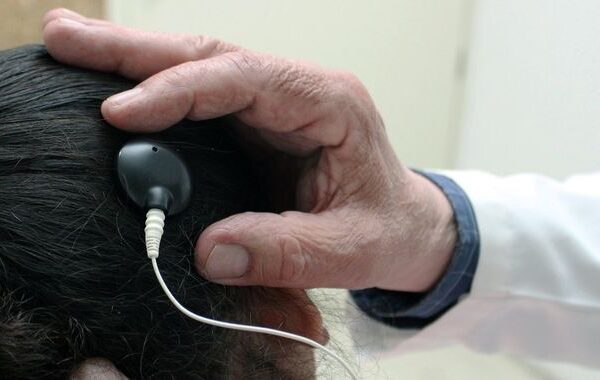 Transforma vidas UMAE Hospital de Pediatría en IMSS Jalisco con 70 procedimientos en el Día Internacional del Implante Coclear