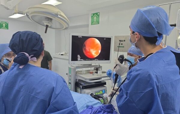 Impulsa ISSSTE procedimientos de diagnóstico por broncoscopia para la detección de cáncer de pulmón