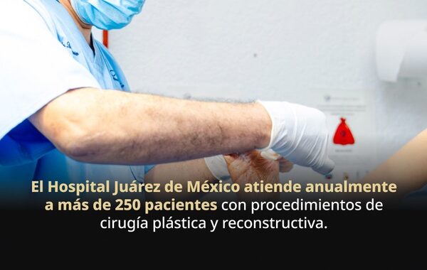 Hospital Juárez de México, referente nacional en cirugía reconstructiva