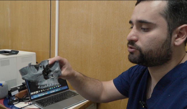 Especialistas del IMSS corrigen asimetría facial con cirugía ortognática de precisión y tecnología tridimensional