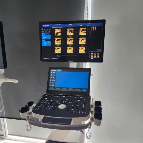 Entrega Martí Batres equipamiento e insumos médicos al HRAE del ISSSTE en el Estado de México