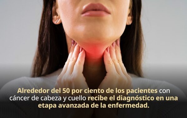 Consumo de tabaco, causa principal de desarrollo de cáncer de cabeza y cuello